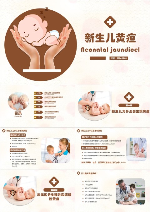 新生儿黄疸知识科普ppt